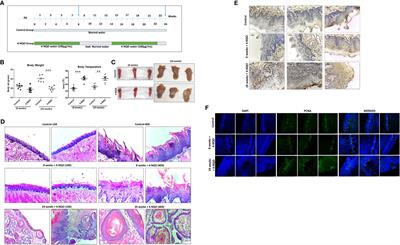 4-nitroquinoline 1-oxide induces immune cells death to onset early immunosuppression during oral squamous cell carcinoma development